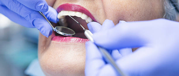 Best Emergency Dentist for Lost Fillings or Crowns in Howey In The Hills, FL